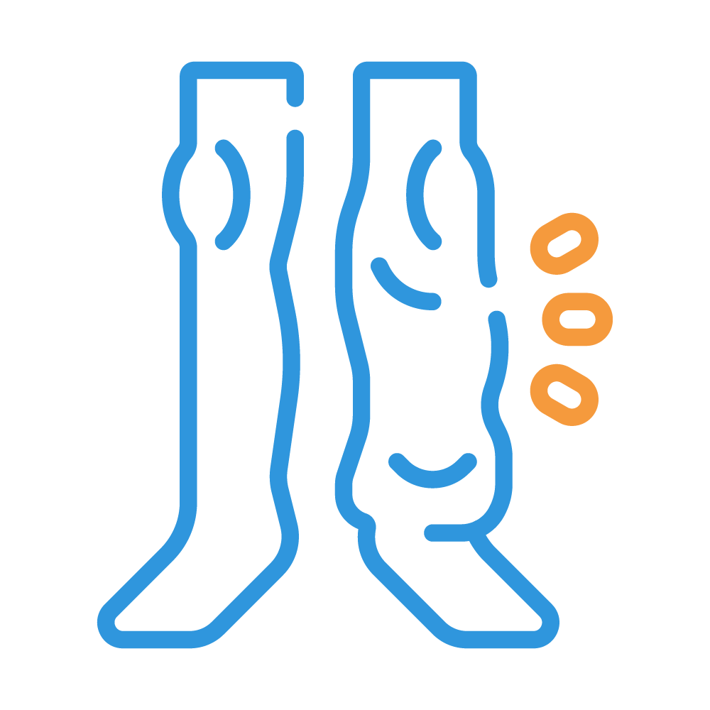 حالات الوذمة اللمفاوية